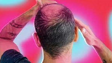 Can hair  supplements reverse hair loss completely